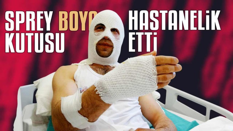 Nişanlısına Hediye Paketi Hazırlarken Sprey Kutusu Patladı: Genç Hastanelik Oldu